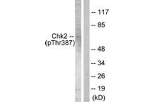 Western blot analysis of extracts from Jurkat cells, using Chk2 (Phospho-Thr387) Antibody. (CHEK2 抗体  (pThr387))