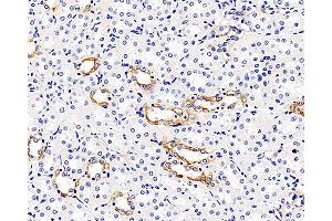 Immunohistochemistry (Paraffin-embedded Sections) (IHC (p)) image for anti-Matrix Metallopeptidase 9 (Gelatinase B, 92kDa Gelatinase, 92kDa Type IV Collagenase) (MMP9) antibody (ABIN7249784)