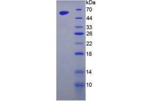 Image no. 1 for Golgi Membrane Protein 1 (GOLM1) (AA 133-379) (Active) protein (His tag,GST tag) (ABIN6239881) (GOLM1 Protein (AA 133-379) (His tag,GST tag))
