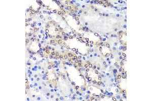 Immunohistochemistry (IHC) image for anti-Proteasome (Prosome, Macropain) Activator Subunit 4 (PSME4) (AA 1634-1843) antibody (ABIN6146359)