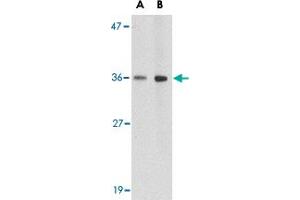 Western blot analysis of HAPLN2 in human brain tissue lysate with HAPLN2 polyclonal antibody  at (A) 1 and (B) 2 ug/mL . (HAPLN2 抗体  (Internal Region))