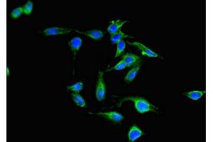 Immunofluorescent analysis of Hela cells using ABIN7169128 at dilution of 1:100 and Alexa Fluor 488-congugated AffiniPure Goat Anti-Rabbit IgG(H+L) (PAK3 抗体  (AA 70-190))