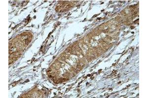 Immunohistochemistry (IHC) image for anti-Phosphatidic Acid Phosphatase Type 2 Domain Containing 1A (PPAPDC1A) (AA 89-149) antibody (ABIN1856403)