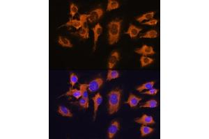 Immunofluorescence analysis of C6 cells using SLC20 antibody (ABIN1682754, ABIN3018562, ABIN3018563 and ABIN6220499) at dilution of 1:100. (SLC20A1 抗体  (AA 257-356))