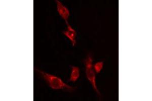 ABIN6274526 staining 293 cells by IF/ICC. (Ethanolamine Kinase 2 抗体  (Internal Region))