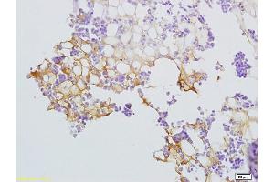 Formalin-fixed and paraffin embedded rat bone marrow labeled with Anti-SLC44A1/CD92 Polyclonal Antibody, Unconjugated (ABIN702370) at 1:200 followed by conjugation to the secondary antibody and DAB staining (SLC44A1 抗体  (AA 81-180))
