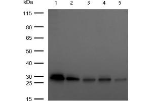 All lanes : C1QBP Rabbit mAb at 1/1k dilution Lane 1 : 293T whole cell lysates Lane 2 : A549 whole cell lysates Lane 3 : Hela whole cell lysates Lane 4 : HepG2 whole cell lysates Lane 5 : C2C12 whole cell lysates Lysates/proteins at 20 μg per lane. (Recombinant C1QBP 抗体)