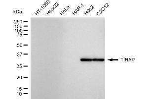 Western blotting analysis using TIRAP antibody (ABIN7800569).