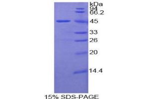 SDS-PAGE analysis of Mouse LAMP2 Protein. (LAMP2 蛋白)