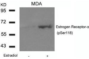 Western blot analysis of extracts from MDA cells untreated or treated with Estradiol using Estrogen Receptor-a(Phospho-Ser118) Antibody. (Estrogen Receptor alpha 抗体  (pSer118))