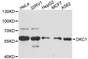 Western blot analysis of extracts of various cell lines, using DKC1 antibody. (DKC1 抗体  (AA 1-180))