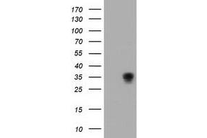 HEK293T cells were transfected with the pCMV6-ENTRY control (Left lane) or pCMV6-ENTRY ACY3 (Right lane) cDNA for 48 hrs and lysed. (Aminoacylase 3 抗体)