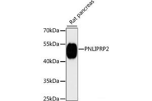 Western blot analysis of extracts of Rat pancreas using PNLIPRP2 Polyclonal Antibody at dilution of 1:3000. (PNLIPRP2 抗体)