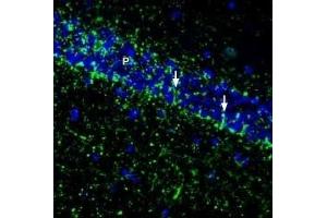 Immunohistochemistry (IHC) image for anti-Solute Carrier Family 23 (Nucleobase Transporters), Member 2 (SLC23A2) (AA 191-204), (Extracellular) antibody (ABIN7043705)