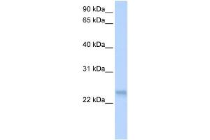 WB Suggested Anti-SFRS3 Antibody Titration: 0. (SRSF3 抗体  (N-Term))