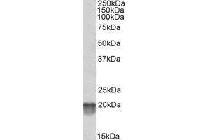 Western Blotting (WB) image for anti-NADH Dehydrogenase (Ubiquinone) Fe-S Protein 7, 20kDa (NADH-Coenzyme Q Reductase) (NDUFS7) (Internal Region) antibody (ABIN2464885) (NDUFS7 抗体  (Internal Region))