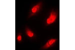 Immunofluorescent analysis of NAA15 staining in THP1 cells. (NAA15 抗体  (Center))