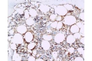 Formalin-fixed and paraffin embedded rat tibia tissue labeled with Anti-BMP2 Polyclonal Antibody, Unconjugated  at 1:200 followed by conjugation to the secondary antibody and DAB staining (BMP2 抗体  (AA 283-365))
