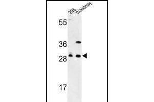 Western blot analysis of GCLM Antibody (C-term) (ABIN653046 and ABIN2842657) in 293 cell line and mouse kidney tissue lysates (35 μg/lane). (GCLM 抗体  (C-Term))