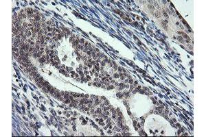 Image no. 1 for anti-Kinesin Family Member 25 (KIF25) antibody (ABIN1499039) (KIF25 抗体)