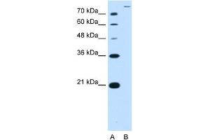 WB Suggested Antibody Titration:  2. (SLC26A5 抗体  (Middle Region))