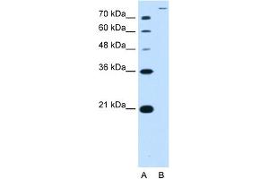 WB Suggested Antibody Titration:  2. (SLC26A5 抗体  (Middle Region))