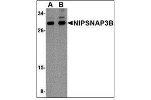 Western blot analysis of NIPSNAP3B in mouse brain tissue lysate with NIPSNAP3B antibody at (A) 1 and (B) 2 µg/ml (NIPSNAP3B 抗体  (Center))