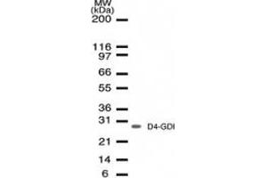 Image no. 1 for anti-rho GDP Dissociation Inhibitor (GDI) beta (ARHGDIB) (AA 125-137) antibody (ABIN207933) (ARHGDIB 抗体  (AA 125-137))