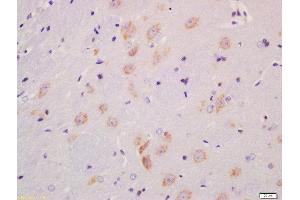 Formalin-fixed and paraffin embedded rat brain labeled with Anti-MST4 + MST3 + STK25 (Thr178 + Thr190 + Thr174) Polyclonal Antibody, Unconjugated  at 1:200 followed by conjugation to the secondary antibody and DAB staining (Mst4 / Mst3 / STK25 (pThr174), (pThr178), (pThr190) 抗体)