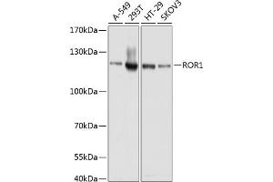 Western blot analysis of extracts of various cell lines, using ROR1 antibody (ABIN1682562, ABIN3017682, ABIN3017683 and ABIN6220210) at 1:1000 dilution. (ROR1 抗体  (AA 30-200))