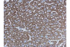 Immunohistochemistry (IHC) image for anti-Ubiquinol-Cytochrome C Reductase Core Protein I (UQCRC1) antibody (ABIN2855203)