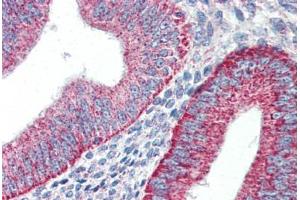 Human Uterus (formalin-fixed, paraffin-embedded) stained with HAVCR1 antibody ABIN337189 at 5 ug/ml followed by biotinylated goat anti-rabbit IgG secondary antibody ABIN481713, alkaline phosphatase-streptavidin and chromogen. (HAVCR1 抗体  (Internal Region))
