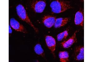 IF analysis of LBR using anti-LBR antibody (ABIN6719340). (Lamin B Receptor 抗体  (AA 102-209))