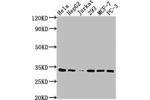 Western Blot Positive WB detected in: Hela whole cell lysate, HepG2 whole cell lysate, Jurkat whole cell lysate, 293 whole cell lysate, MCF-7 whole cell lysate, PC-3 whole cell lysate All lanes: CDK4 antibody at 1:2000 Secondary Goat polyclonal to rabbit IgG at 1/50000 dilution Predicted band size: 34, 21 kDa Observed band size: 34 kDa (Recombinant CDK4 抗体)