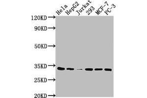 Western Blot Positive WB detected in: Hela whole cell lysate, HepG2 whole cell lysate, Jurkat whole cell lysate, 293 whole cell lysate, MCF-7 whole cell lysate, PC-3 whole cell lysate All lanes: CDK4 antibody at 1:2000 Secondary Goat polyclonal to rabbit IgG at 1/50000 dilution Predicted band size: 34, 21 kDa Observed band size: 34 kDa (Recombinant CDK4 抗体)