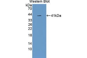Detection of Recombinant GPLD1, Human using Polyclonal Antibody to Glycosylphosphatidylinositol Specific Phospholipase D1 (GPLD1) (GPLD1 抗体  (AA 496-840))