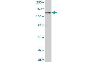 RNF20 MaxPab polyclonal antibody. (RNF20 抗体  (AA 1-975))