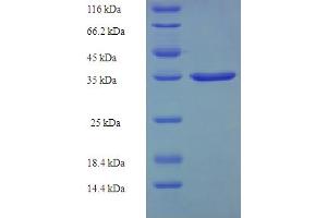 SDS-PAGE (SDS) image for AlkB, Alkylation Repair Homolog 3 (ALKBH3) (AA 1-170) protein (His-SUMO Tag) (ABIN5711658) (ALKBH3 Protein (AA 1-170) (His-SUMO Tag))