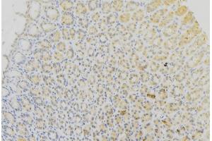 ABIN6273618 at 1/100 staining Human gastric tissue by IHC-P. (CYB5B 抗体  (Internal Region))