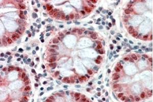 Immunohistochemistry (IHC) image for anti-Patched 1 (PTCH1) (C-Term) antibody (ABIN185521)