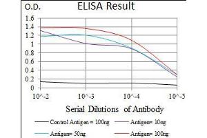 Black line: Control Antigen (100 ng), Purple line: Antigen(10 ng), Blue line: Antigen (50 ng), Red line: Antigen (100 ng), (Calmegin 抗体  (AA 249-405))