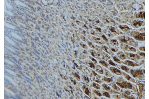 Immunohistochemistry (IHC) image for anti-Succinate Dehydrogenase Complex, Subunit A, Flavoprotein (Fp) (SDHA) (Internal Region) antibody (ABIN6264955)
