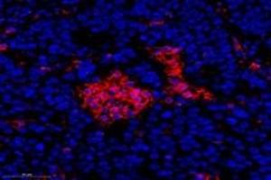 Immunofluorescent analysis of paraformaldehyde-fixed human ovay cancer using FLJ22167 (ABIN7073961) at dilution of 1: 1400 (FLJ22167 抗体)