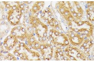 Immunohistochemistry of paraffin-embedded Mouse kidney using GALC Polyclonal Antibody at dilution of 1:100 (40x lens). (GALC 抗体)