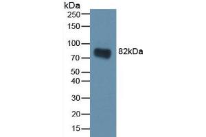 Western blot analysis of recombinant Rat CA2. (CA2 抗体)
