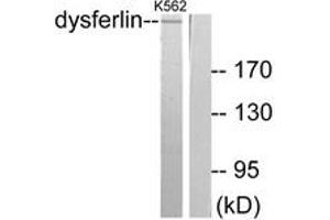 Western blot analysis of extracts from K562 cells, using Dysferlin Antibody. (Dysferlin 抗体  (AA 1981-2030))