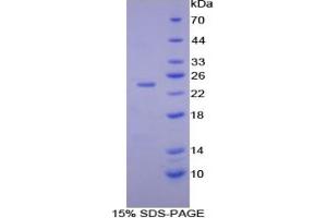 Mouse Detection antibody from the kit in WB with Positive Control: Human lymphocyte lysates. (IL-10 ELISA 试剂盒)