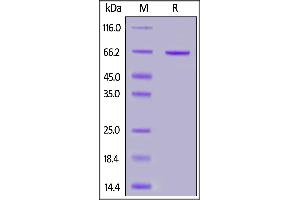 Human Syndecan-1, Fc Tag on  under reducing (R) condition.
