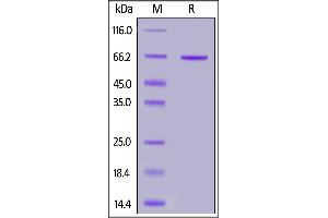 Human Syndecan-1, Fc Tag on  under reducing (R) condition. (Syndecan 1 Protein (SDC1) (AA 23-254) (Fc Tag))