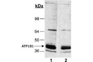 Detection of ATP1B1 in rat kidney homogenates (20 ug) using ATP1B1 monoclonal antibody, clone 464. (ATP1B1 抗体)